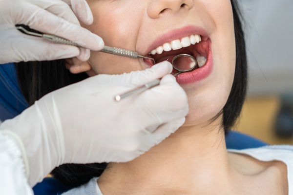 What To Avoid After Getting A New Dental Filling